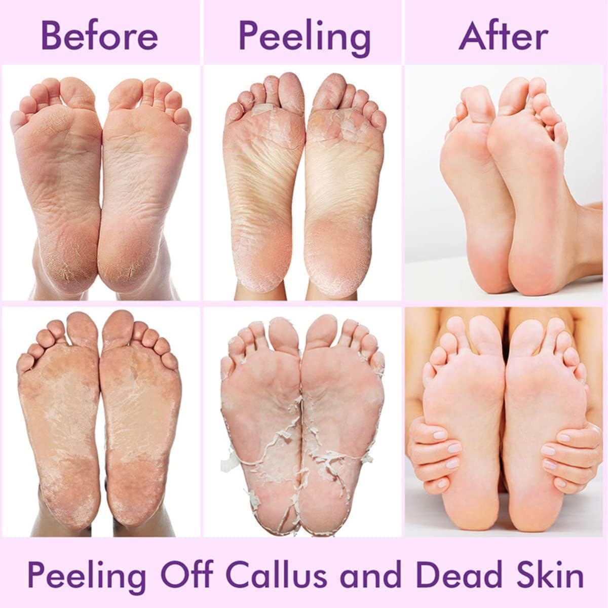 Exfoliating Foot Mask Cherry